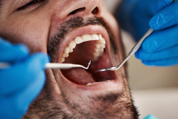 Best Dentist for Tooth Abscess  in Silver City, NM